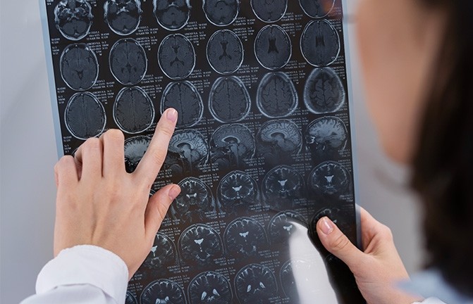 1 декабря — День невролога. Поздравляем наших замечательных специалистов! - Новости